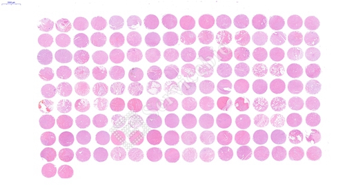 组织芯片扫描（白光）(图1)