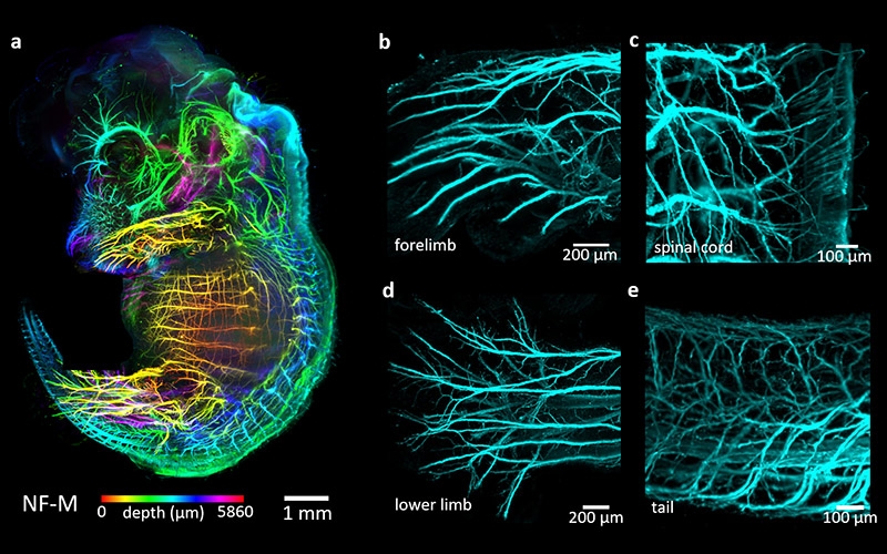 组织透明化成像技术：开启生命科学研究的全新视角(图5)