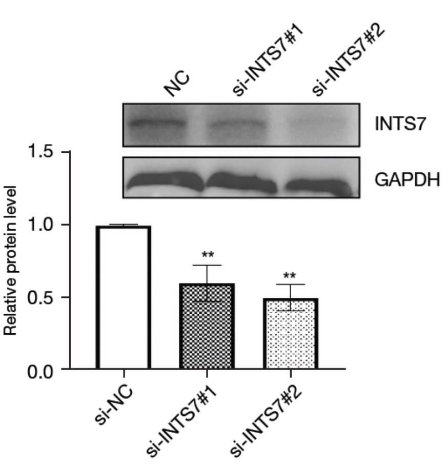 GNI4310-GH/Anti-GAPDH-HRP(图2)