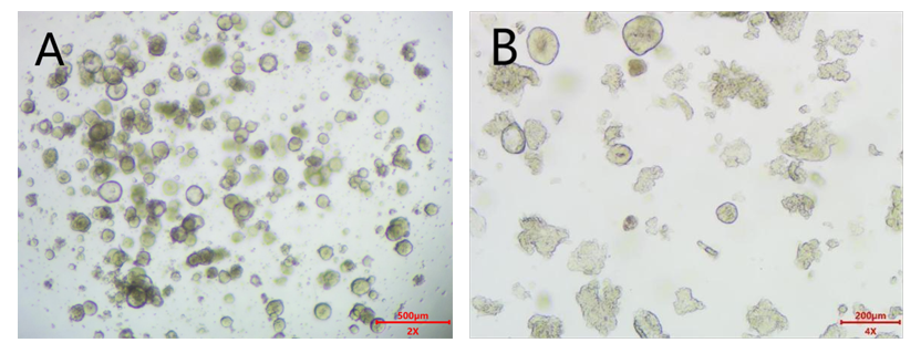 肺癌类器官培养基试剂盒(JFKR-LC-100-KIT/JFKR-LC-500-KIT)(图3) 1742356298615.png