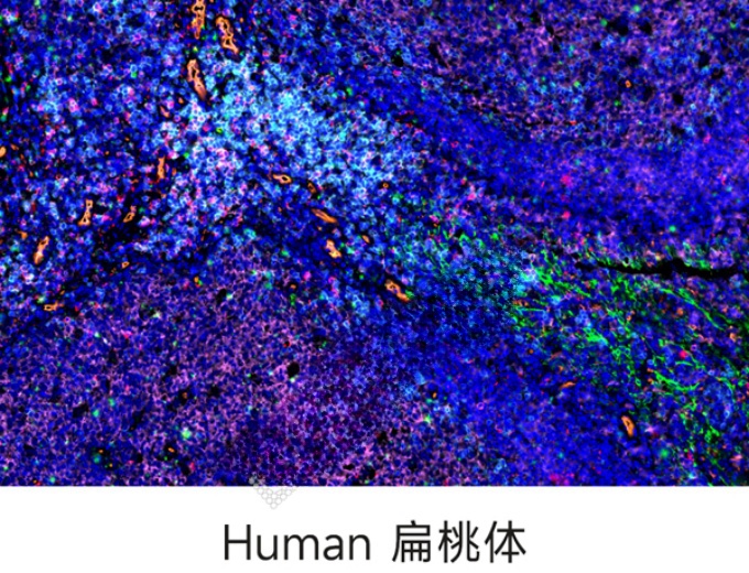 组织芯片扫描（荧光五标 六色）(图1)