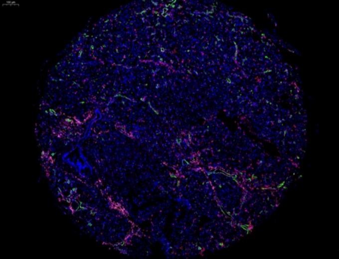 组织芯片扫描（荧光四标 五色）(图1)