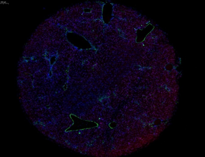 组织芯片扫描（荧光双标 三色）(图2)