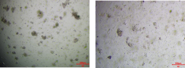 肝实质细胞癌类器官培养基试剂盒( JFKR-HCC-100-KIT/ JFKR-HCC-500-KIT)(图1) 鼠胃癌类器官培养基试剂盒( JFKR-MGC-100-KIT/ JFKR-MGC-500-KIT)(图1)