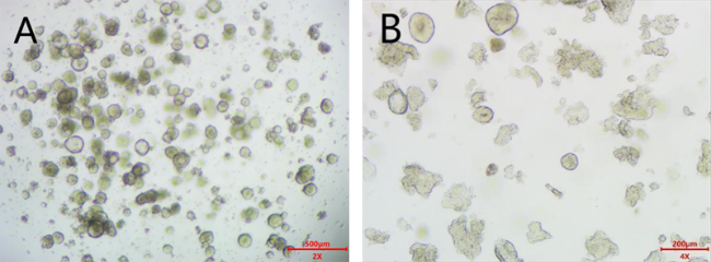 肝实质细胞癌类器官培养基试剂盒( JFKR-HCC-100-KIT/ JFKR-HCC-500-KIT)(图3) 子宫内膜癌类器官培养基试剂盒(JFKR-EC-100-KIT/JFKR-EC-500-KIT)(图3)