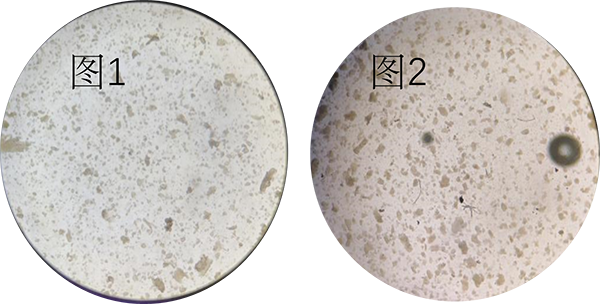 胃癌类器官培养基(JFKR-CRC-100/JFKR-CRC-500)(图5) 胃癌类器官培养基(JFKR-CRC-100/JFKR-CRC-500)(图5)