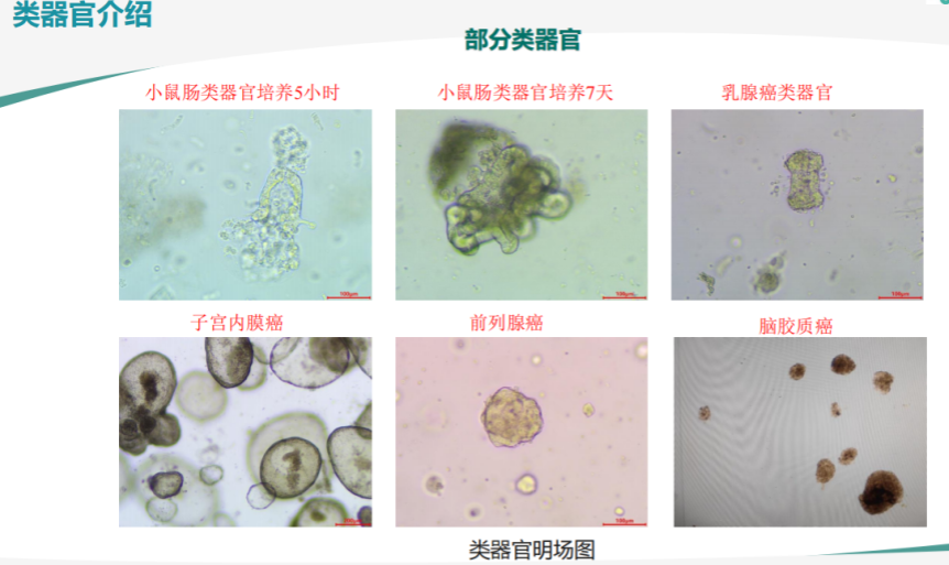 胃癌类器官培养基(JFKR-CRC-100/JFKR-CRC-500)(图2) 1730252600814.png