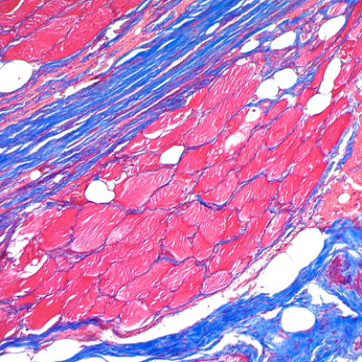 Masson染色（胶原纤维）