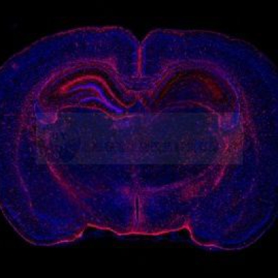 普通切片扫描（荧光单标扫描 双色）