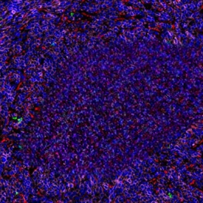 普通切片扫描（荧光三标扫描 四色）