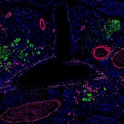 普通切片扫描（荧光四标扫描 五色）