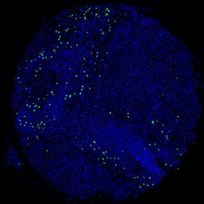 组织芯片扫描（荧光单标 双色）
