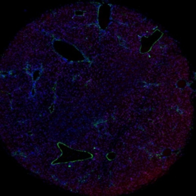组织芯片扫描（荧光双标 三色）