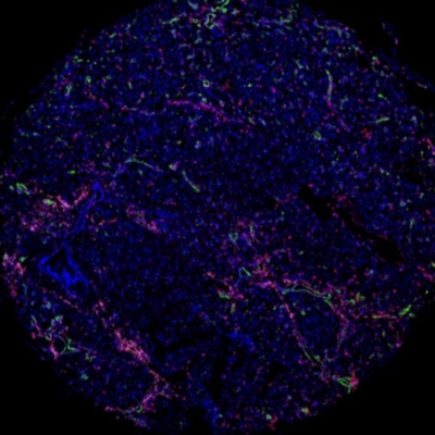 组织芯片扫描（荧光三标 四色）