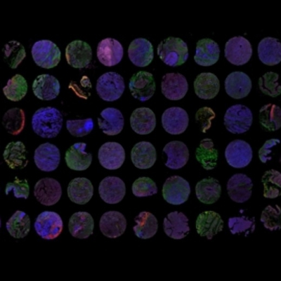 组织芯片扫描（荧光四标 五色）