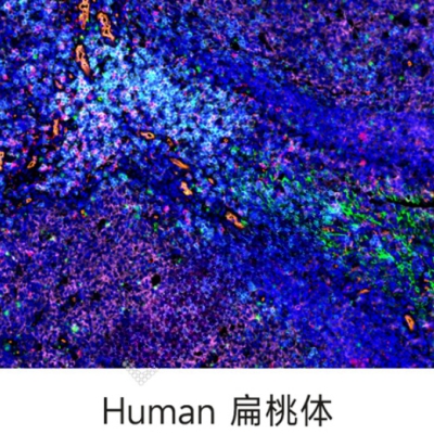 组织芯片扫描（荧光六标 七色）