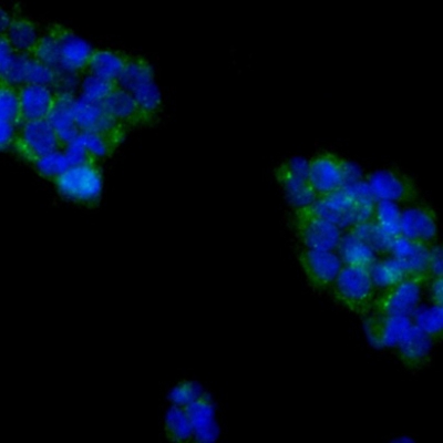 Cytokeratin 18 Rabbit Polyclon