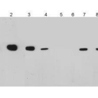 CD34 Rabbit Polyclonal Antibod