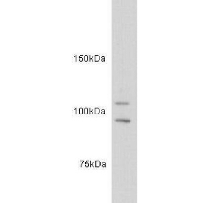 c-kit Rabbit Polyclonal Antibo