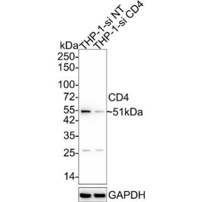CD4 Rabbit Polyclonal Antibody
