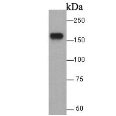 EGFR Rabbit Polyclonal Antibod