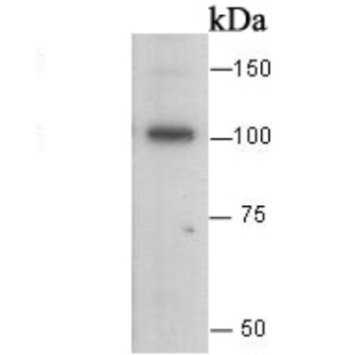 E Cadherin Rabbit Polyclonal A