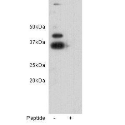 ZFP-42/REX-1 Rabbit Polyclonal