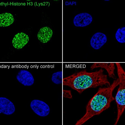 Histone H3 (tri methyl K27) Re