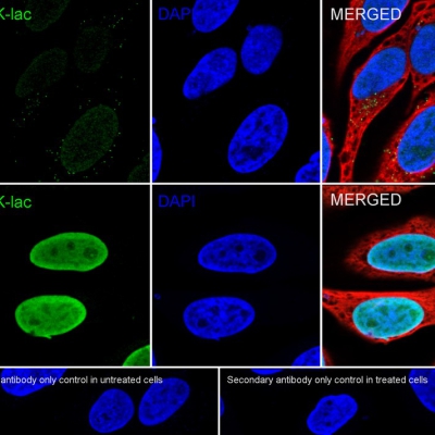 Pan-Lactyl-lysine Recombinant 