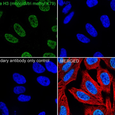 Histone H3 (mono+di+tri methyl