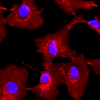 WGA染色（心肌细胞）