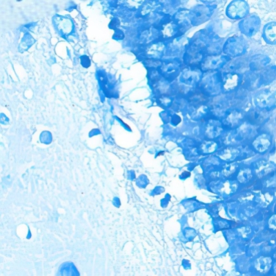 尼氏染色（尼氏小体）