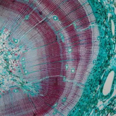 番红固绿染色（骨结构）