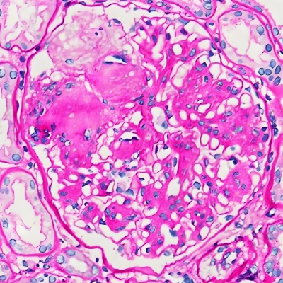 PAS染色（中性粘液和杯状细胞）