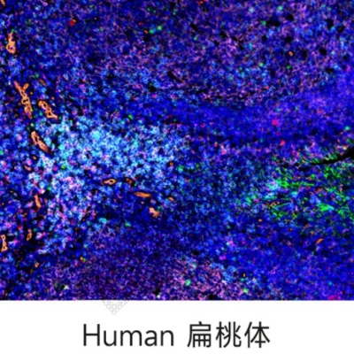 组织芯片扫描（荧光五标 六色）