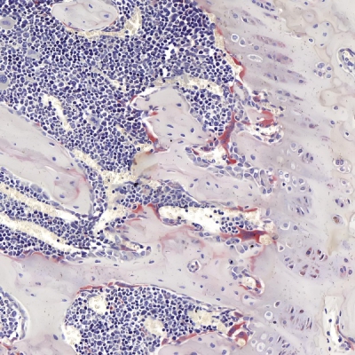 TRAP染色（破骨细胞）