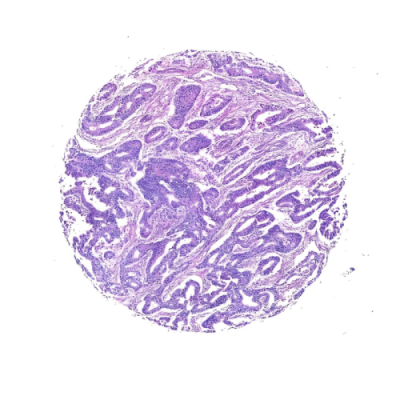 组织芯片扫描（白光）