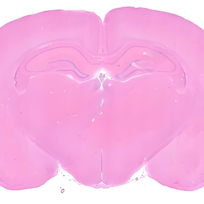 普通切片白光扫描