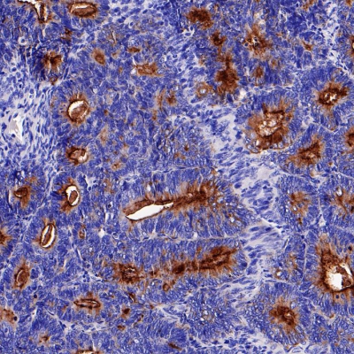 MUC1 Recombinant Rabbit Monocl