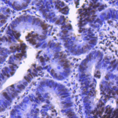 Cdk9 Recombinant Rabbit Monocl