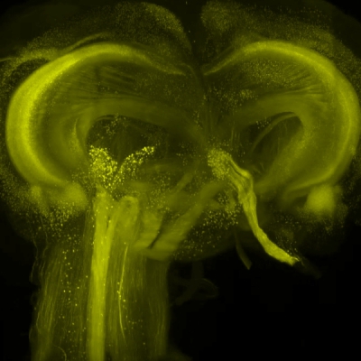 透视大脑奥秘：LifeCanvas 小鼠全脑透明化技术开启神经科学新视野