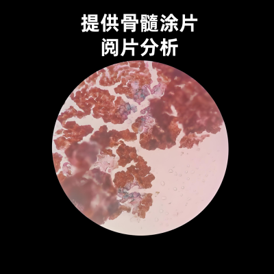 <strong>提供骨髓涂片制片/阅片分析技术服务</strong>