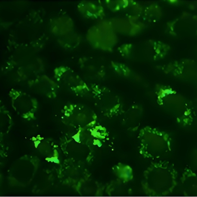 <strong>DHE/ROS染色（活性氧染色）</strong>