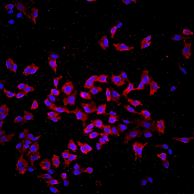 <strong>BrdU染色（细胞增殖检测）</strong>