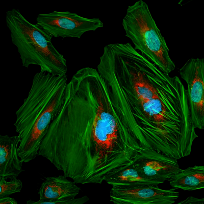 <strong>鬼笔环肽染色(细胞骨架）</strong>