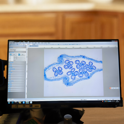 免疫组化染色（及石蜡切片）