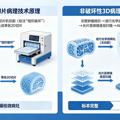 非破坏性3D病理技术：肿瘤诊断与精准医疗的新前沿数字病理技术